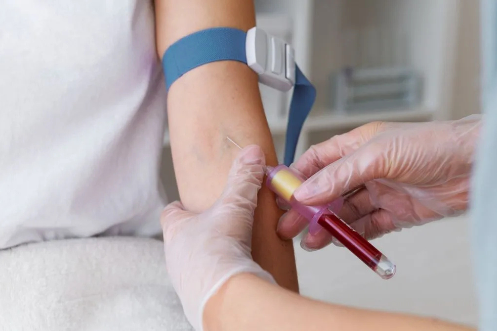 10 Essential Medical Tests Everyone Should Do Every Year